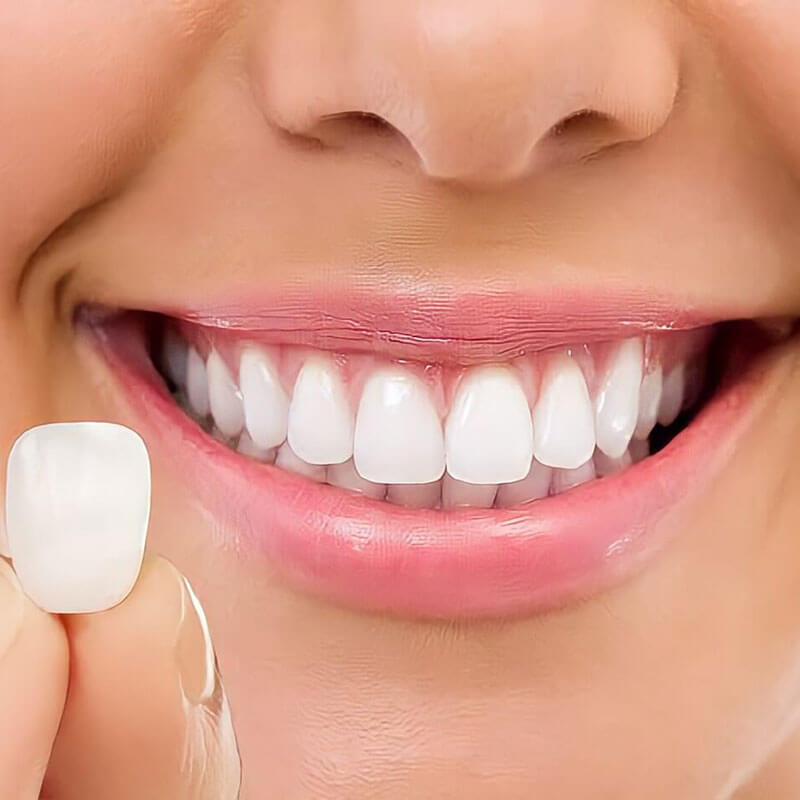 Protese e lentes de contato dental